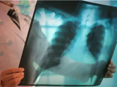 Aumento de infecciones respiratorias en República Dominicana genera preocupación