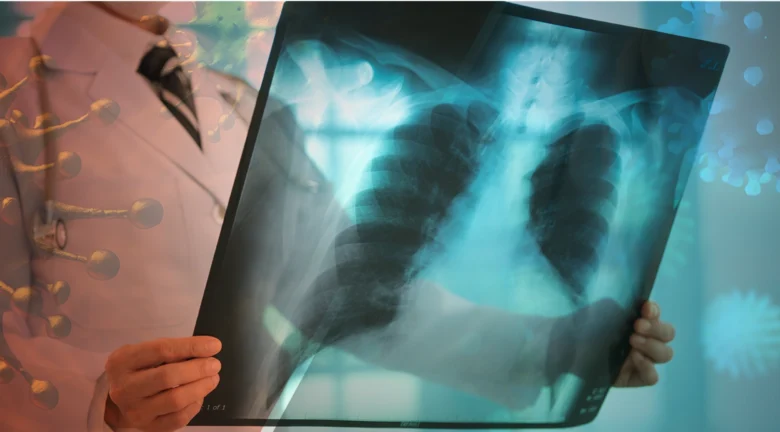 Aumento de infecciones respiratorias en República Dominicana genera preocupación