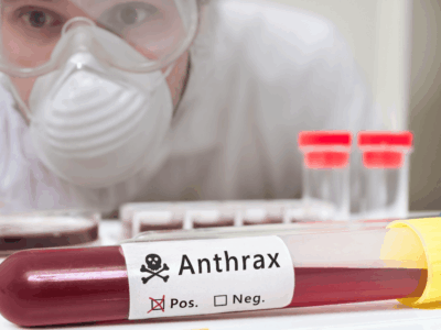 República Dominicana en alerta ante posible caso de ántrax, informa Salud Pública