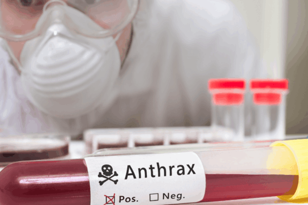República Dominicana en alerta ante posible caso de ántrax, informa Salud Pública