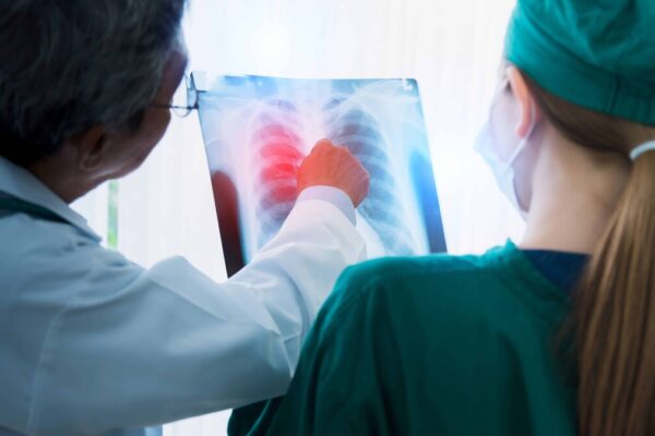 La Importancia del Diagnóstico Precoz del Cáncer Pulmonar
